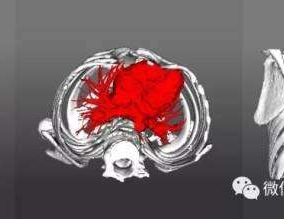 The spatial relationship between the chest wall, spine, and heart