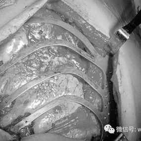 After the tumor resection, the digital material perfectly fit the defect