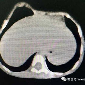 Preoperative imaging examination