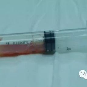 Intraoperative drainage of pus from the abscess