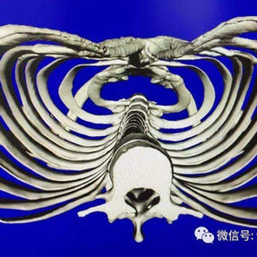 Three-dimensional reconstruction image