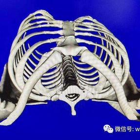 Three-dimensional reconstruction image