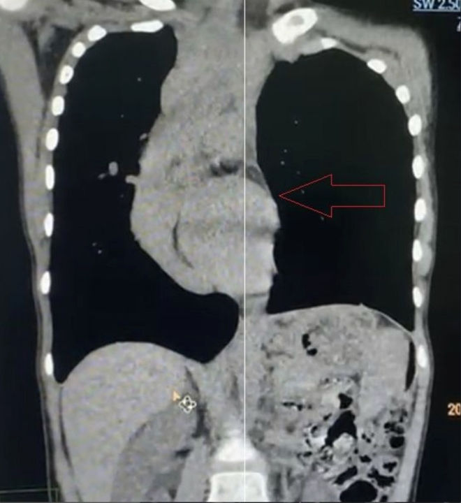 The heart is located in the right thoracic cavity.