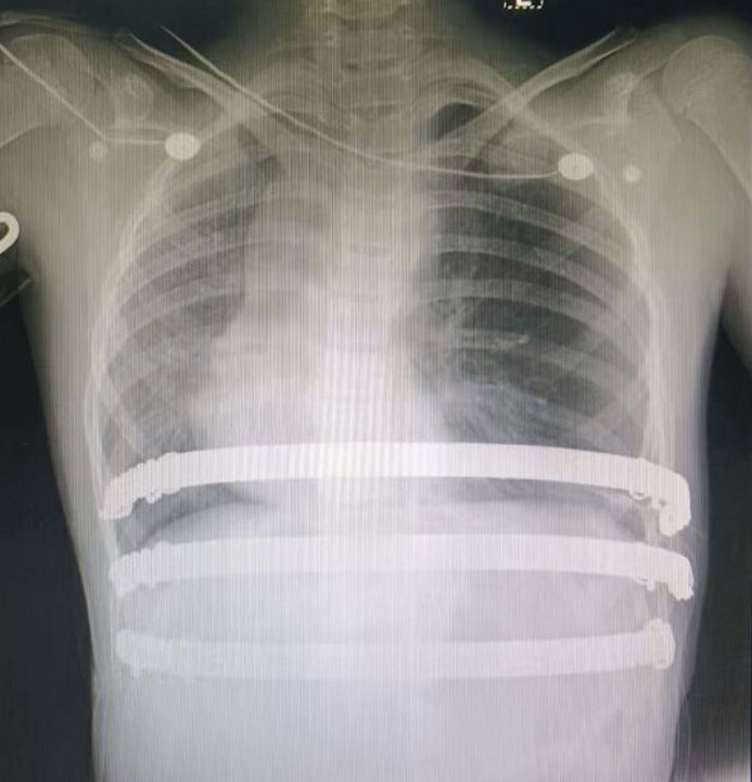 Postoperative imaging
