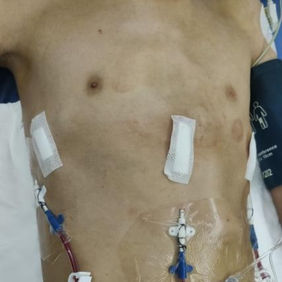 The deformity disappeared after the surgery