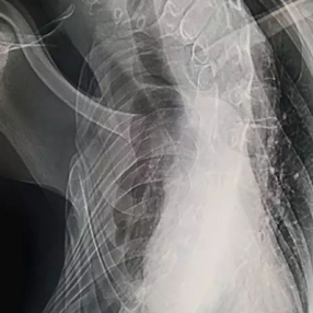 Preoperative X-ray Examination