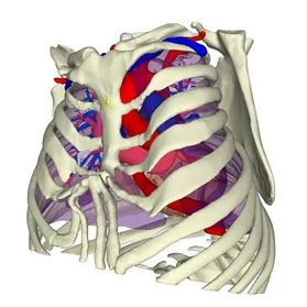 The anterior chest wall exhibits severe deformities.