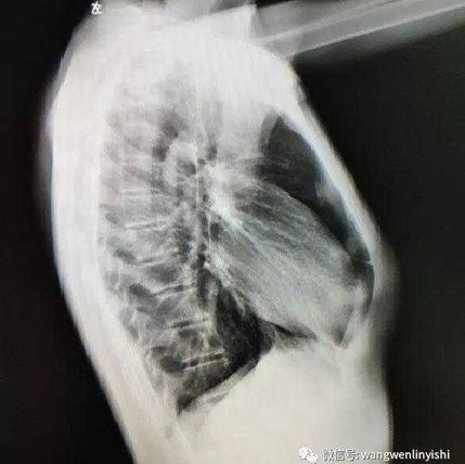 X-ray examination before surgery
