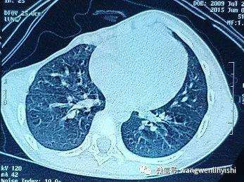 Image test before the surgery