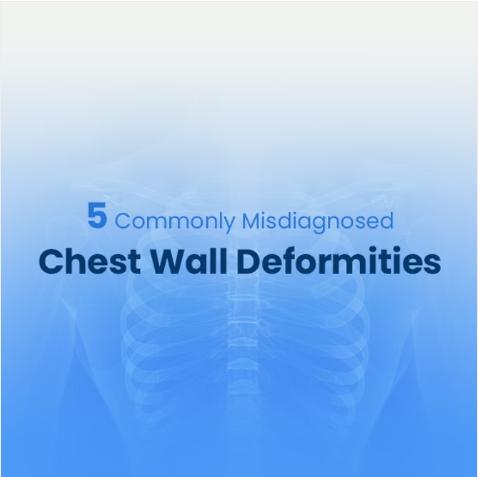 5 commonly misdiagnosed chest wall deformities