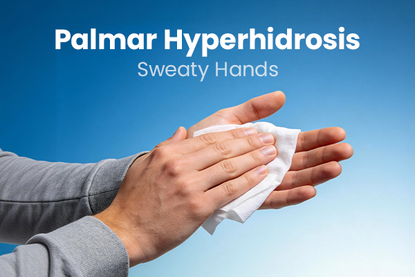 palmar hyperhidrosis (sweaty hands)
