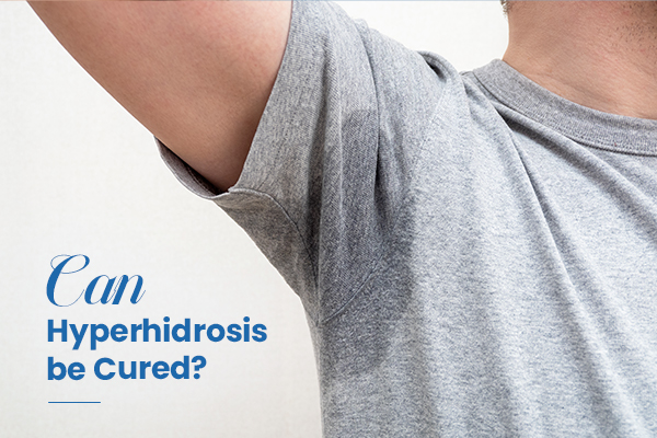 Can Hyperhidrosis be Cured?