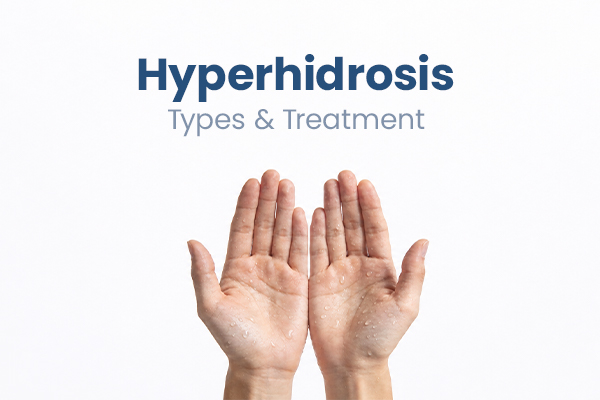 hyperhidrosis types and treatments